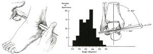 Ankle Graph